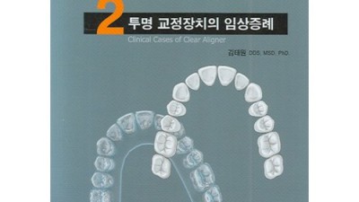 투명교정 후기🦷: 몰라보게 예뻐지는 비결 (솔직&할인정보)